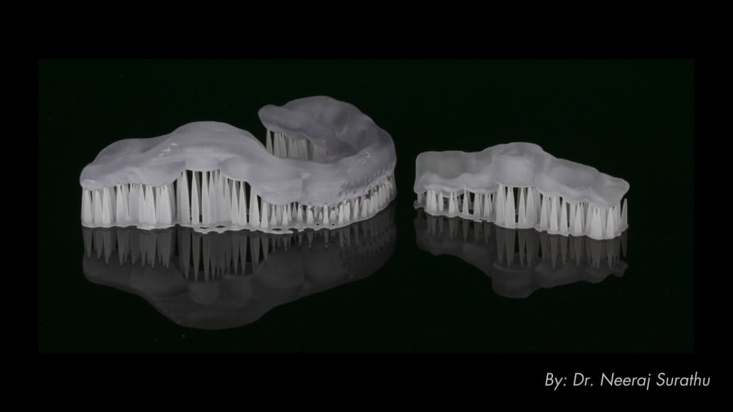 3D printed surgical guide with supports, straight from the 3D printer