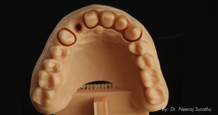 Dental 3D Model Printed with the PRO 20