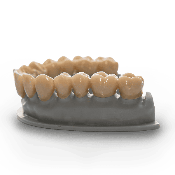 Image of 3D printed crowns and bridges using RS VIVO C&B Crown